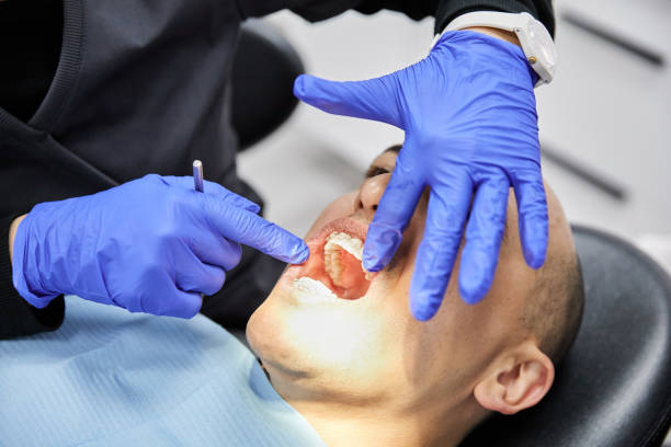 Best Urgent Tooth Repair  in Combee Settlement, FL